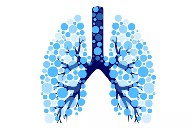 Pneumonitis