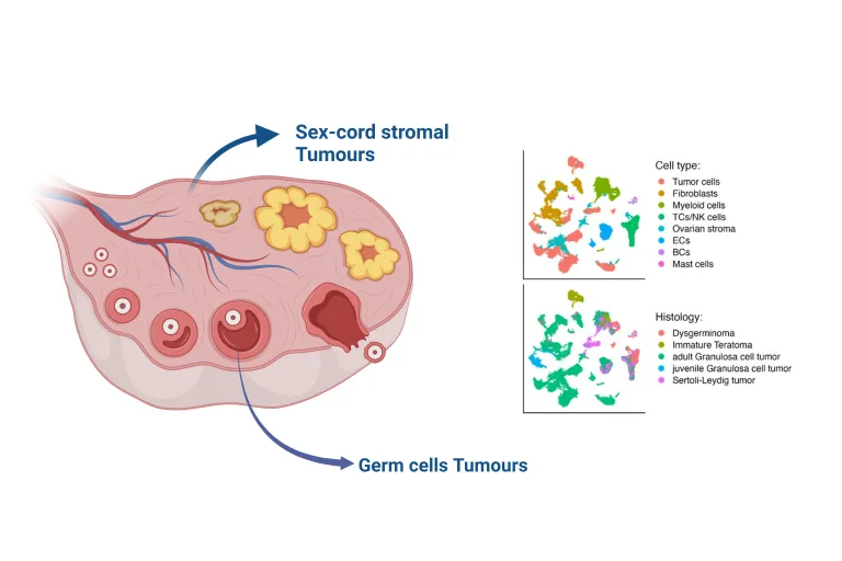 Sex cord tumors