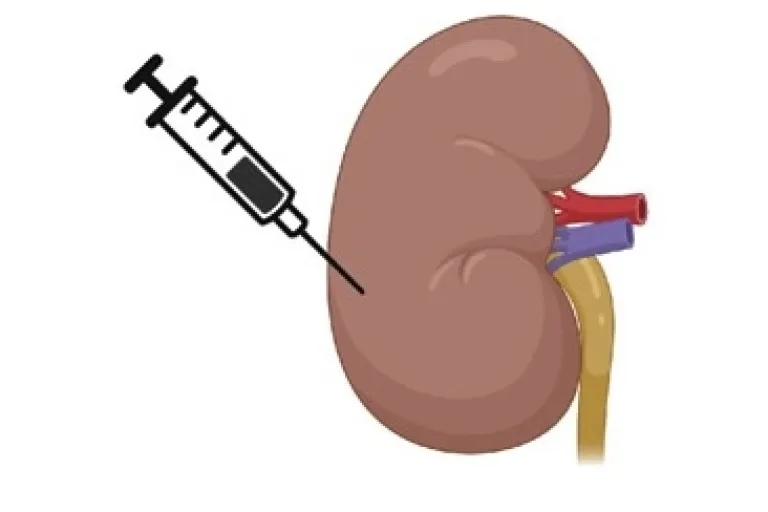 FSGS