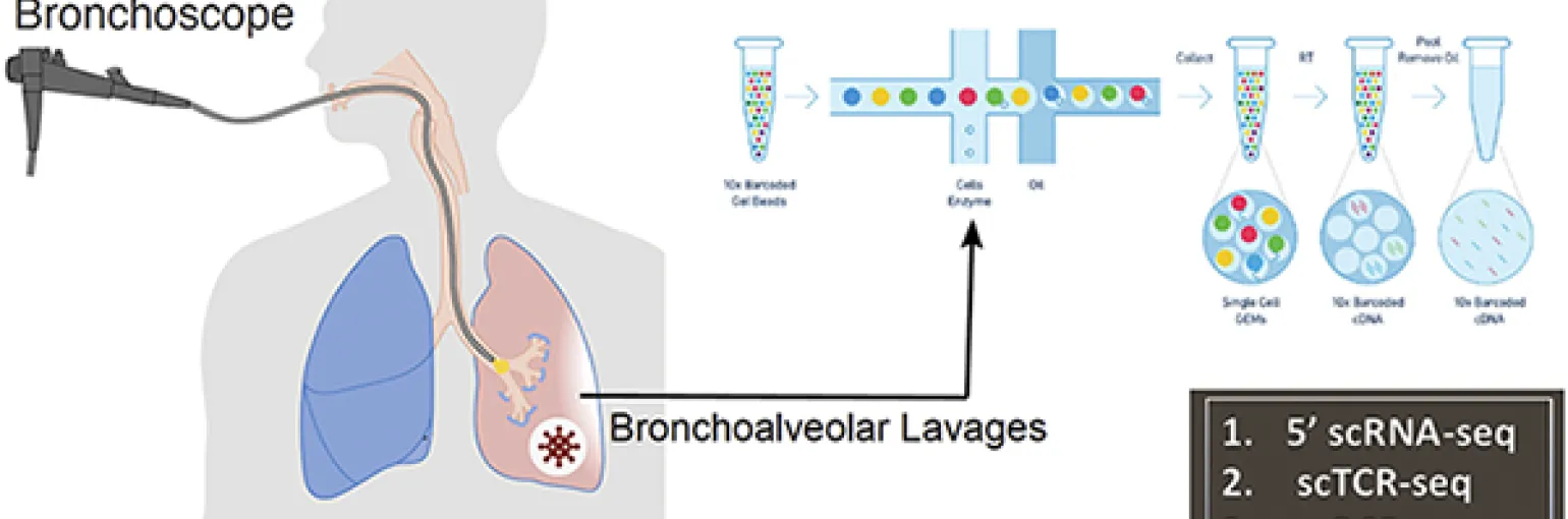 Immune atlas of COVID-19 Bronchoalveolar Lavages