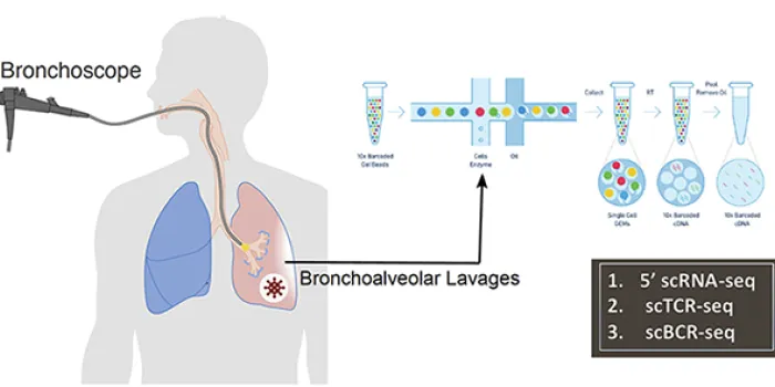 Immune atlas of COVID-19 Bronchoalveolar Lavages
